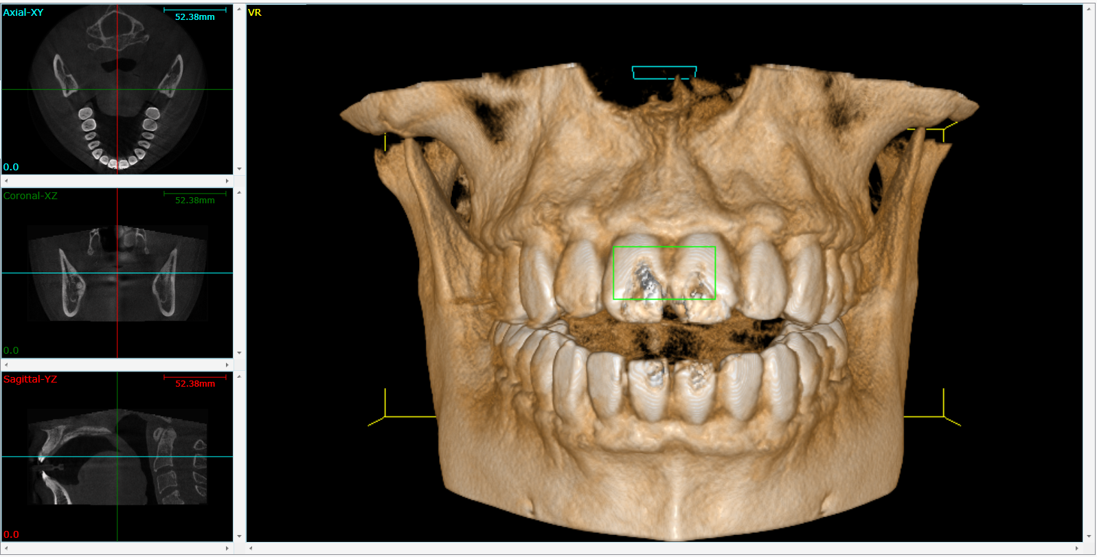 Cone Beam 3D Imaging  Edmonton, AB TJ B